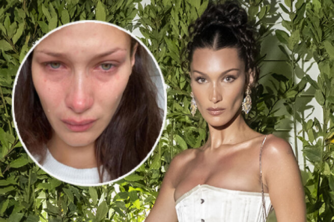 Bella Hadid spoke about psychological problems