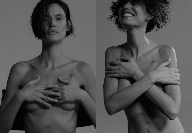 Model Bianca Balti shows off her surgery scars after ovarian cancer treatment