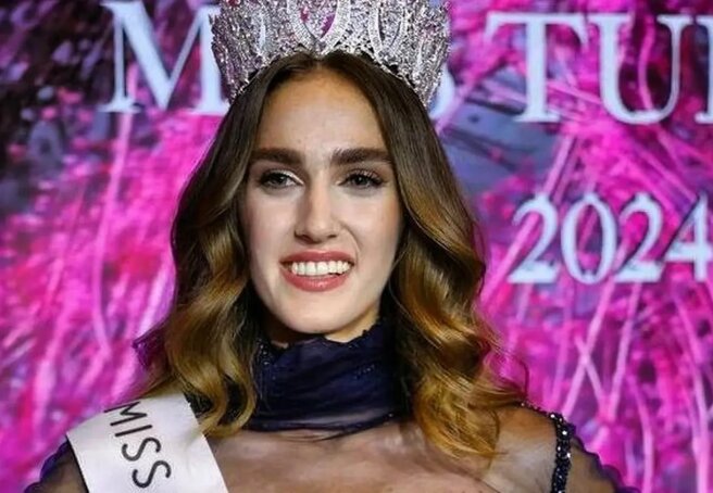 Miss Turkey winner criticized for her appearance, called 'masculine'