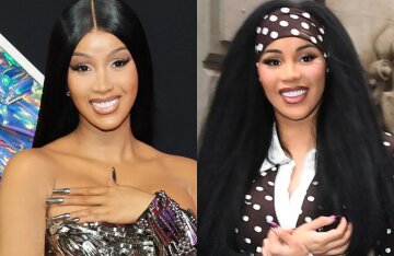 Cardi B is suspected of having undergone new plastic surgery.