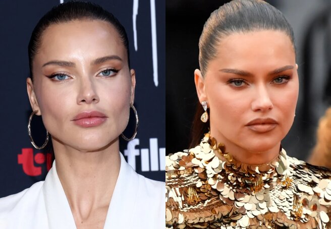 "Getting Her Look Back." Adriana Lima Steps Out, Sparks Rumors She's Had Fillers Removed