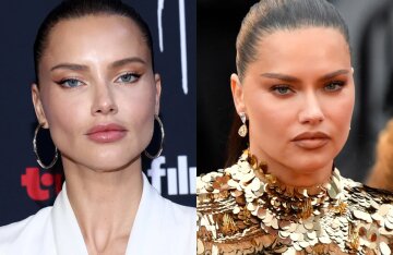 "Getting Her Look Back." Adriana Lima Steps Out, Sparks Rumors She's Had Fillers Removed