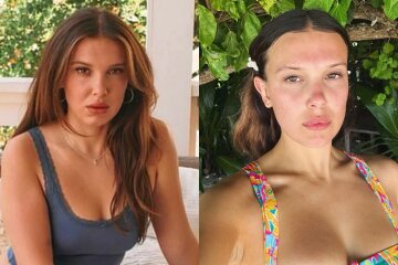 "She looks 40." Millie Bobby Brown suspected of having a passion for fillers