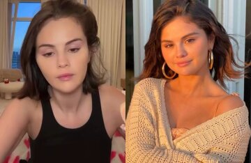 "Lips Blown Off." Selena Gomez's "New" Face Discussed Online