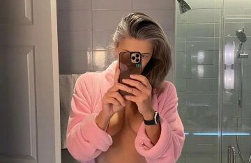 58-year-old model Paulina Porizkova showed scars after surgery