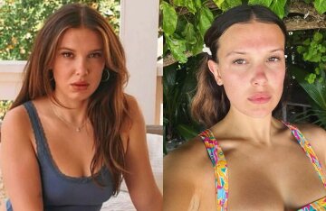 "She looks 40." Millie Bobby Brown suspected of having a passion for fillers