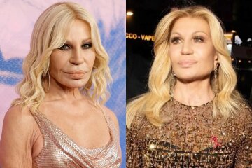 "A Wizard, Not a Surgeon." The Internet Discusses Donatella Versace's "New" Face