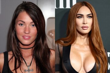 Plastic surgery, Botox, fillers: how Megan Fox changed