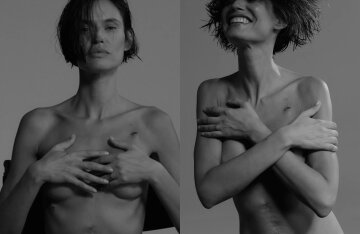 Model Bianca Balti shows off her surgery scars after ovarian cancer treatment