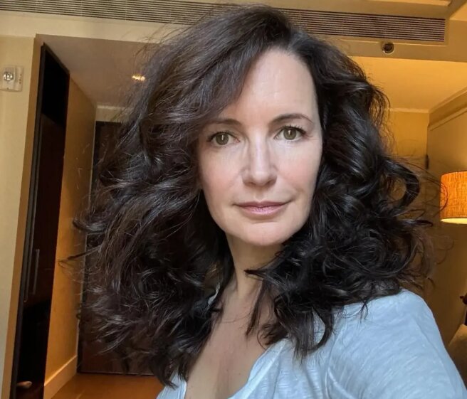 "You look 10 years younger." Kristin Davis posted a photo after having her fillers removed