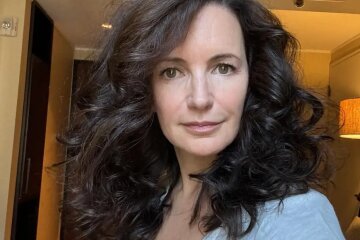 "You look 10 years younger." Kristin Davis posted a photo after having her fillers removed