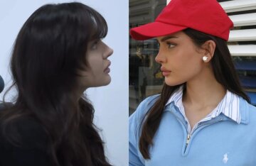 Dina Saeva shared a photo of herself after her nose surgery.