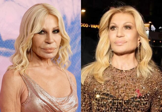 "A Wizard, Not a Surgeon." The Internet Discusses Donatella Versace's "New" Face