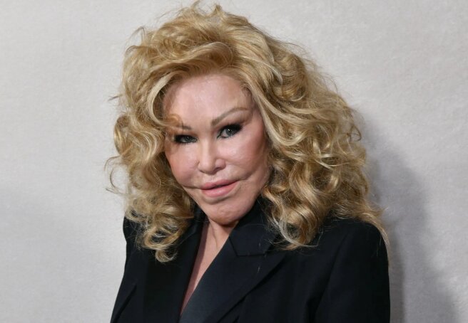 'Catwoman' Jocelyn Wildenstein, famous for her plastic surgeries, dies