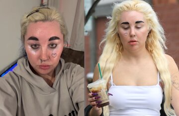 Photos of Amanda Bynes, who has lost a significant amount of weight after taking Ozempic, have surfaced online.