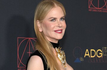 The Internet is discussing the "strange" shape of Nicole Kidman's ears, which may be the result of unsuccessful plastic surgery