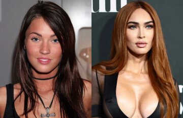 Plastic surgery, Botox, fillers: how Megan Fox changed