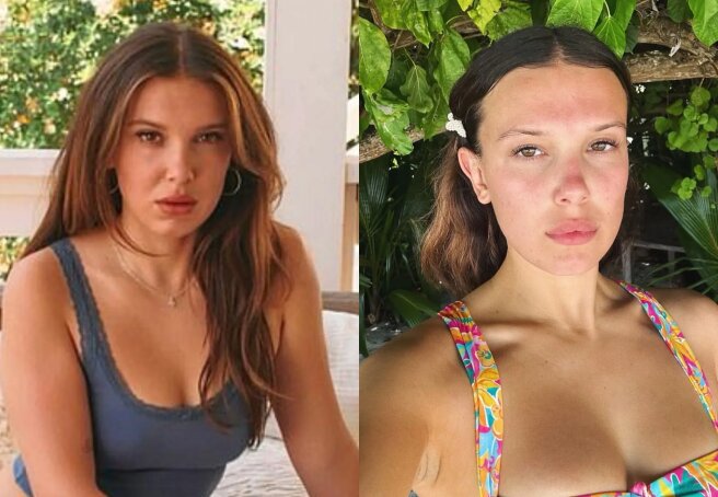 "She looks 40." Millie Bobby Brown suspected of having a passion for fillers