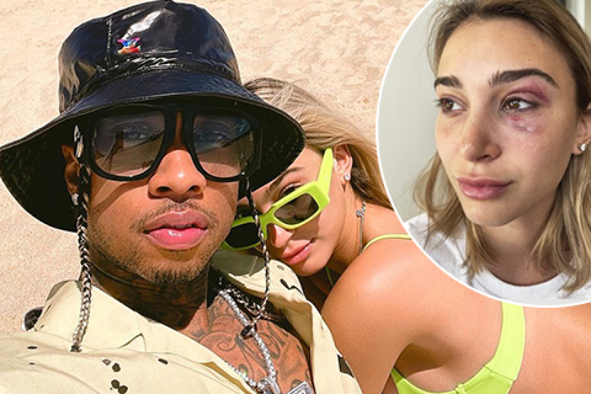 Kylie Jenner&rsquo;s ex-boyfriend rapper Tyga accused of domestic violence